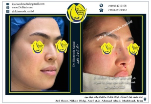combined-facial-plastic-surgery-1