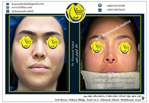 combined-facial-plastic-surgery-2