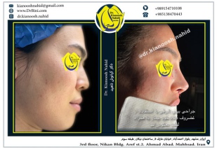 combined-facial-plastic-surgery-3