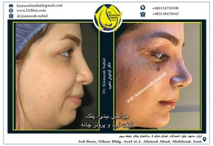 combined-facial-plastic-surgery-5